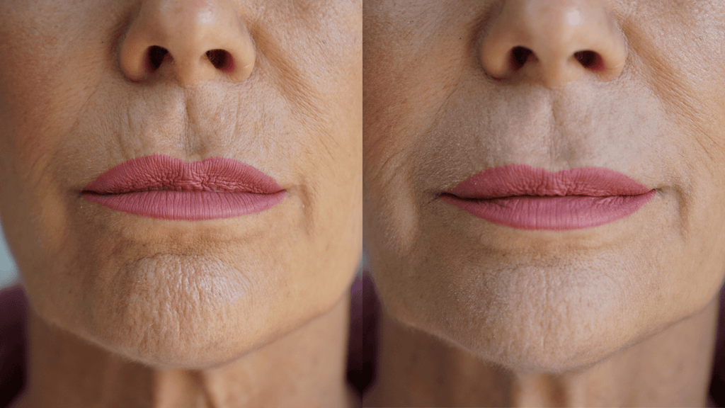 Ageless Lip & Line Filler - Insatiable Sensations