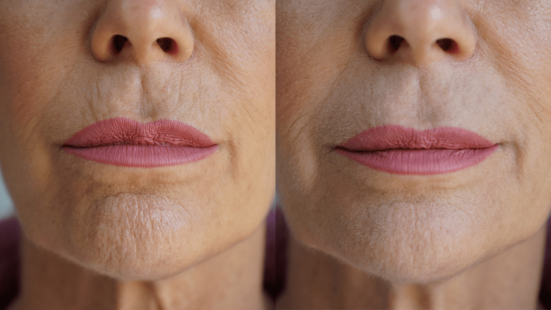Ageless Lip & Line Filler - Insatiable Sensations
