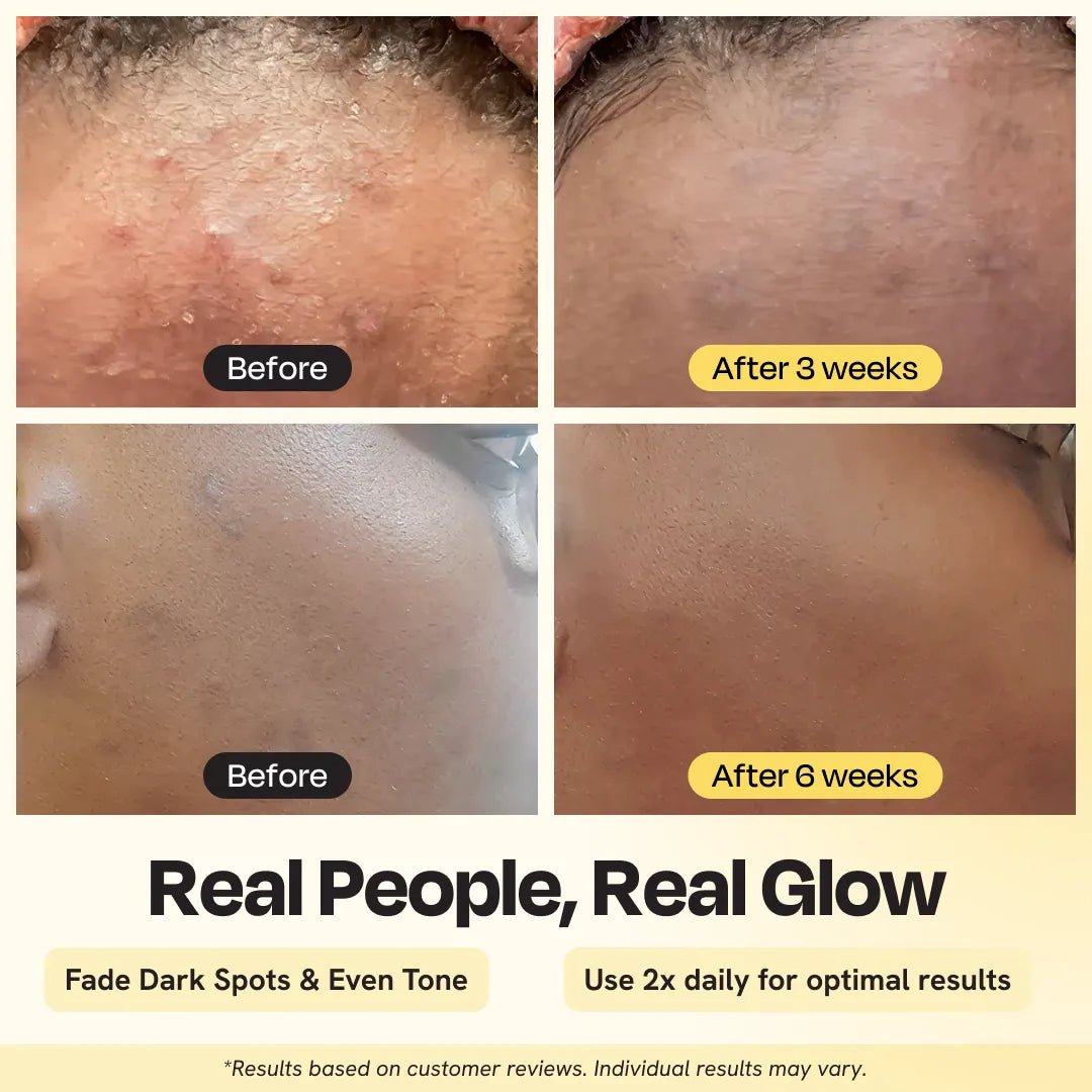 Advanced Brightening Moisturizer - Insatiable Sensations