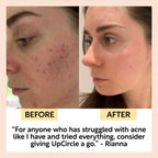 Travel-Size Skincare Bundle - Insatiable Sensations