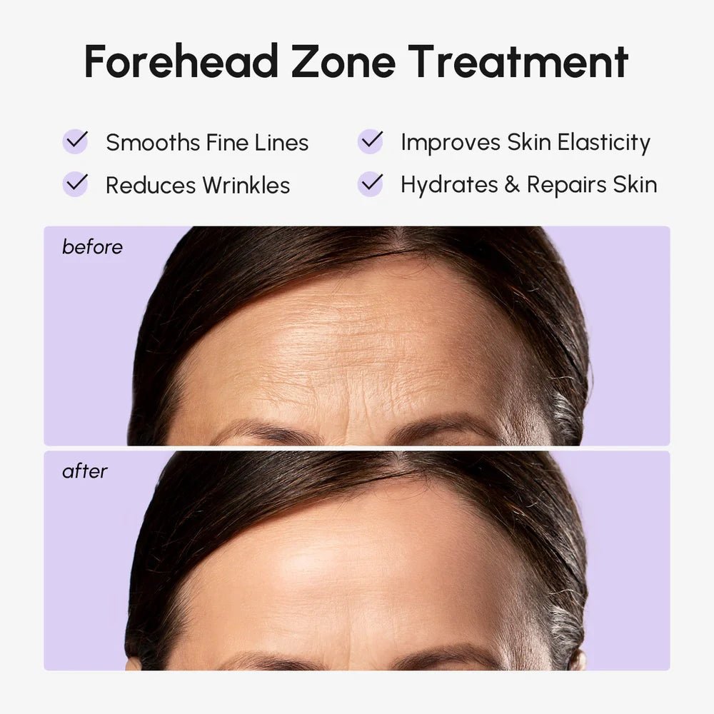 Anti-Wrinkle Forehead Patches - Insatiable Sensations
