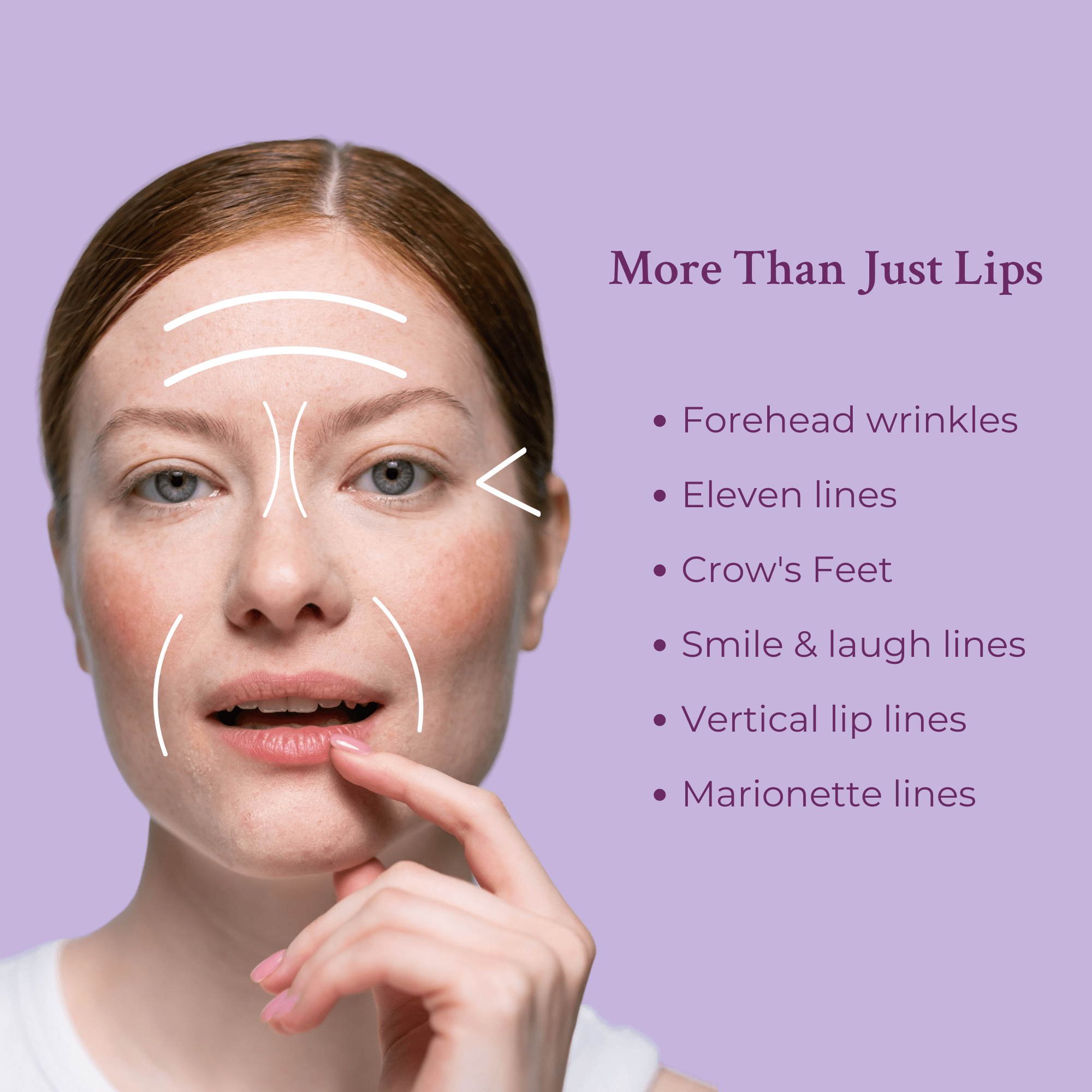 Ageless Lip & Line Filler - Insatiable Sensations